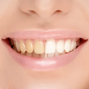 Clinica Dental Ale-Encar Melipilla
