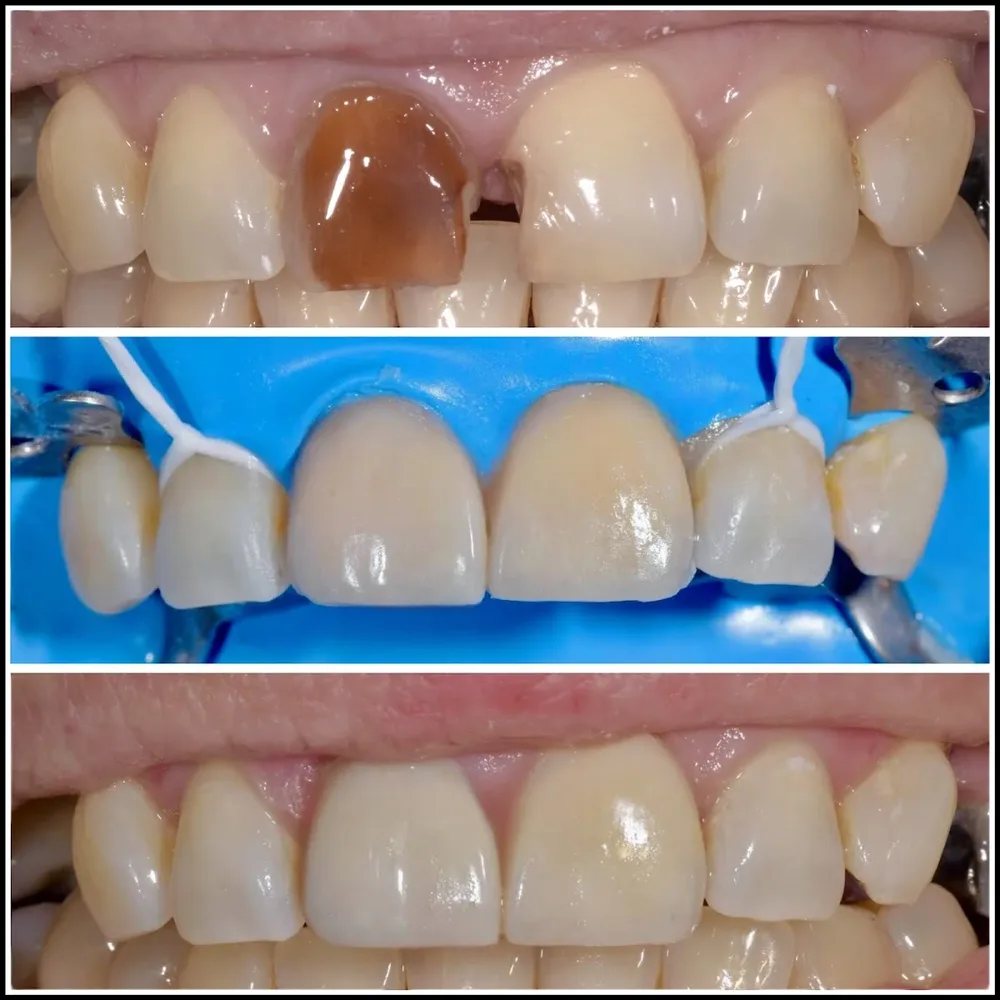 Clínica Dental Artis Río Bueno