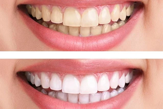 Clínica Dental Carrera