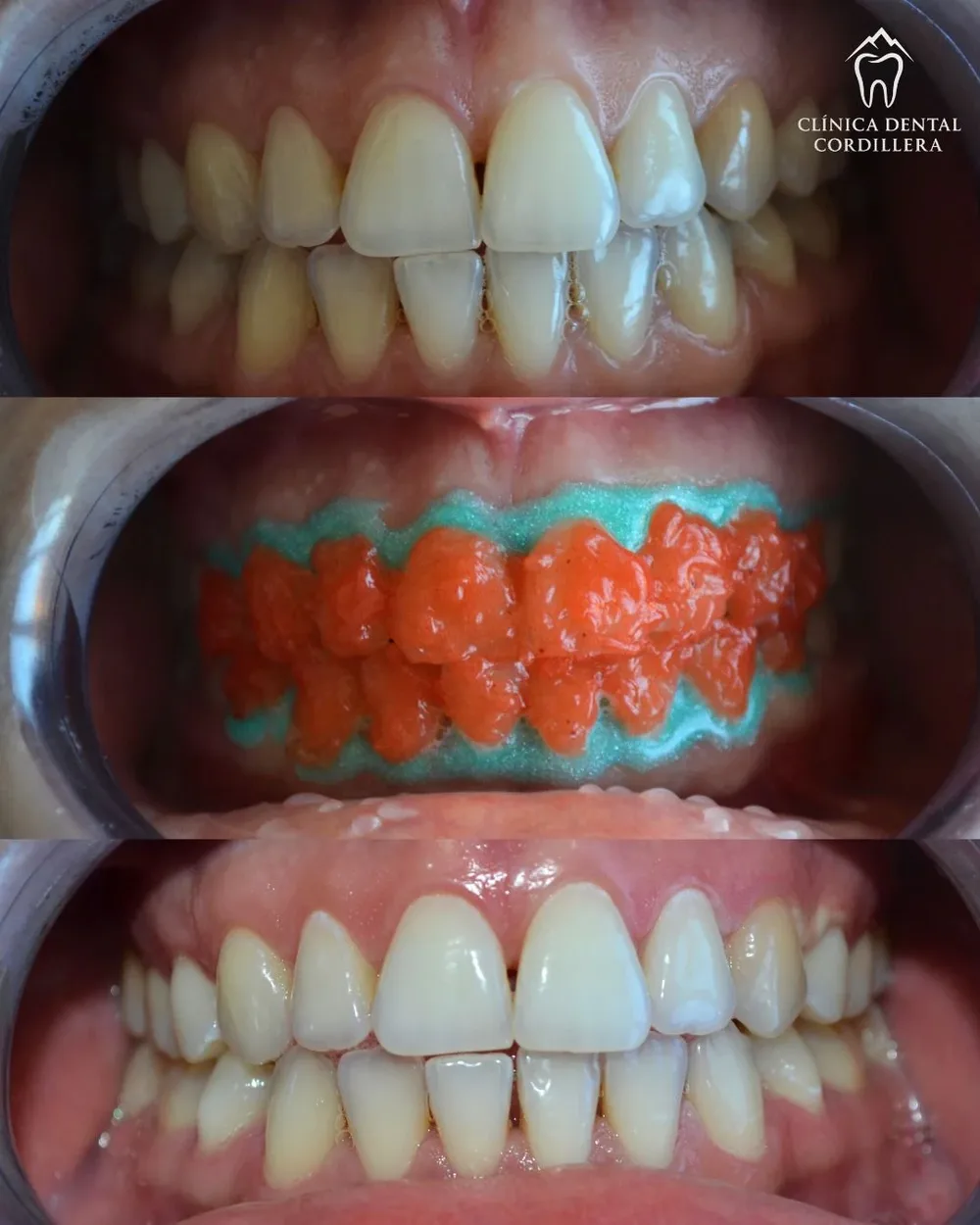 Clinica Dental Cordillera Temuco