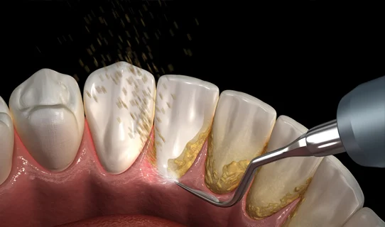 Clínica Dental San Pablo