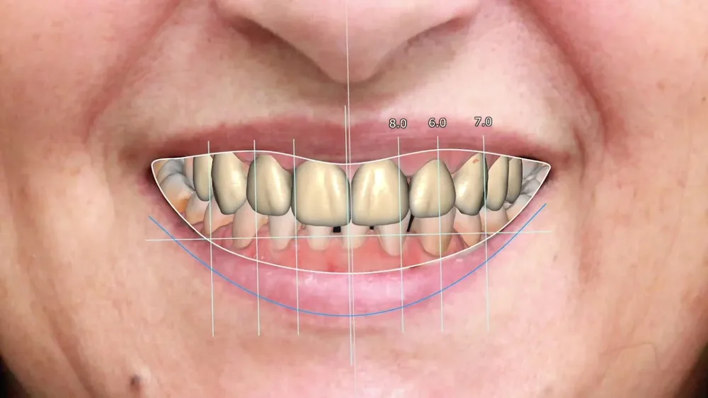Clínica dental Viña del mar: Dr. Javier González