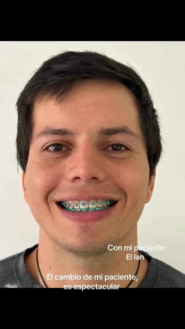 DAYRA RANGEL | DENTISTA COPIAPO
