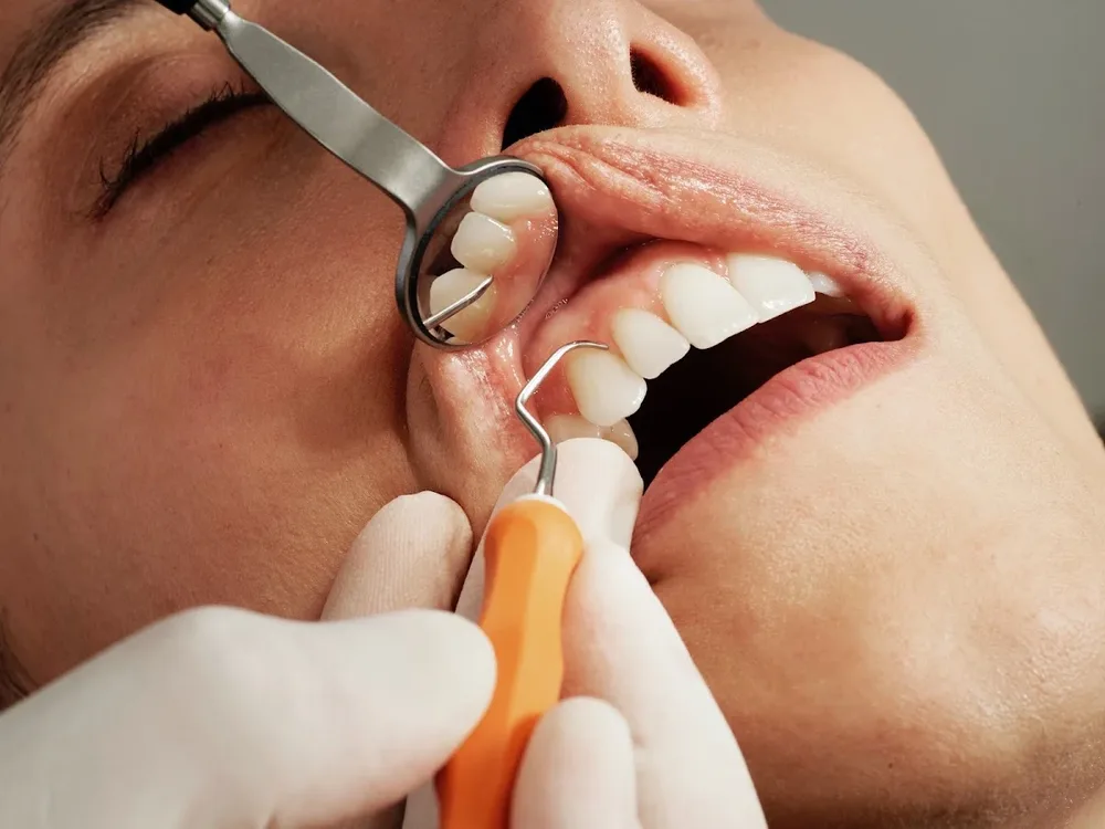 Dentista La Serena
