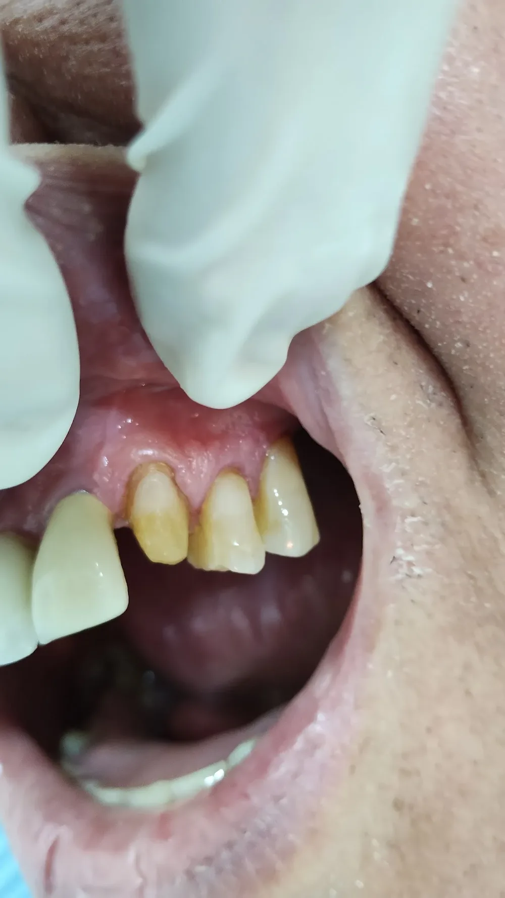 ODONTOLOGÍA BASTIDAS