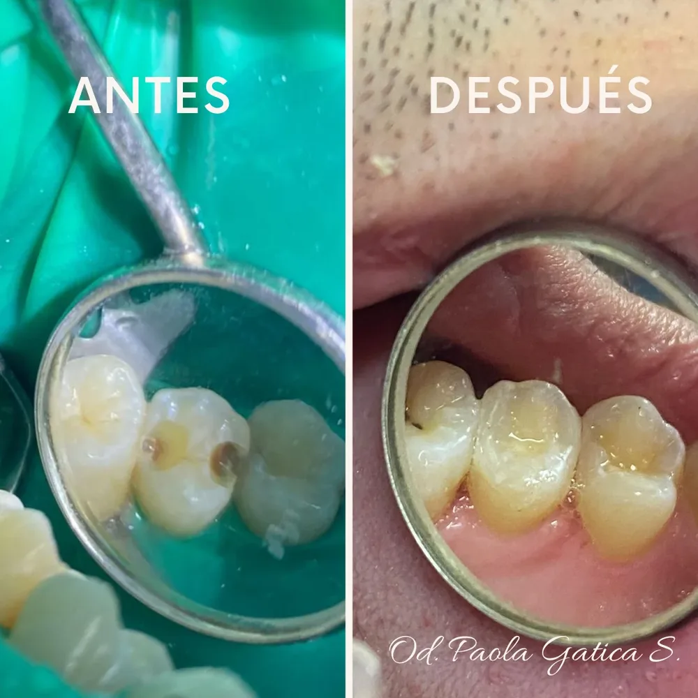 Urgencia Dental Temuco, dentista temuco