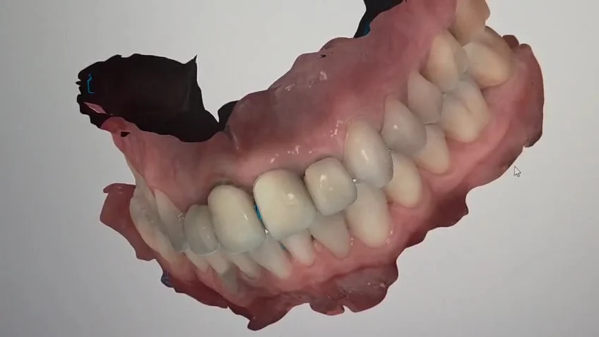 Urgencia dental Viña del Mar 24/7 - Clínica Dental TOBA