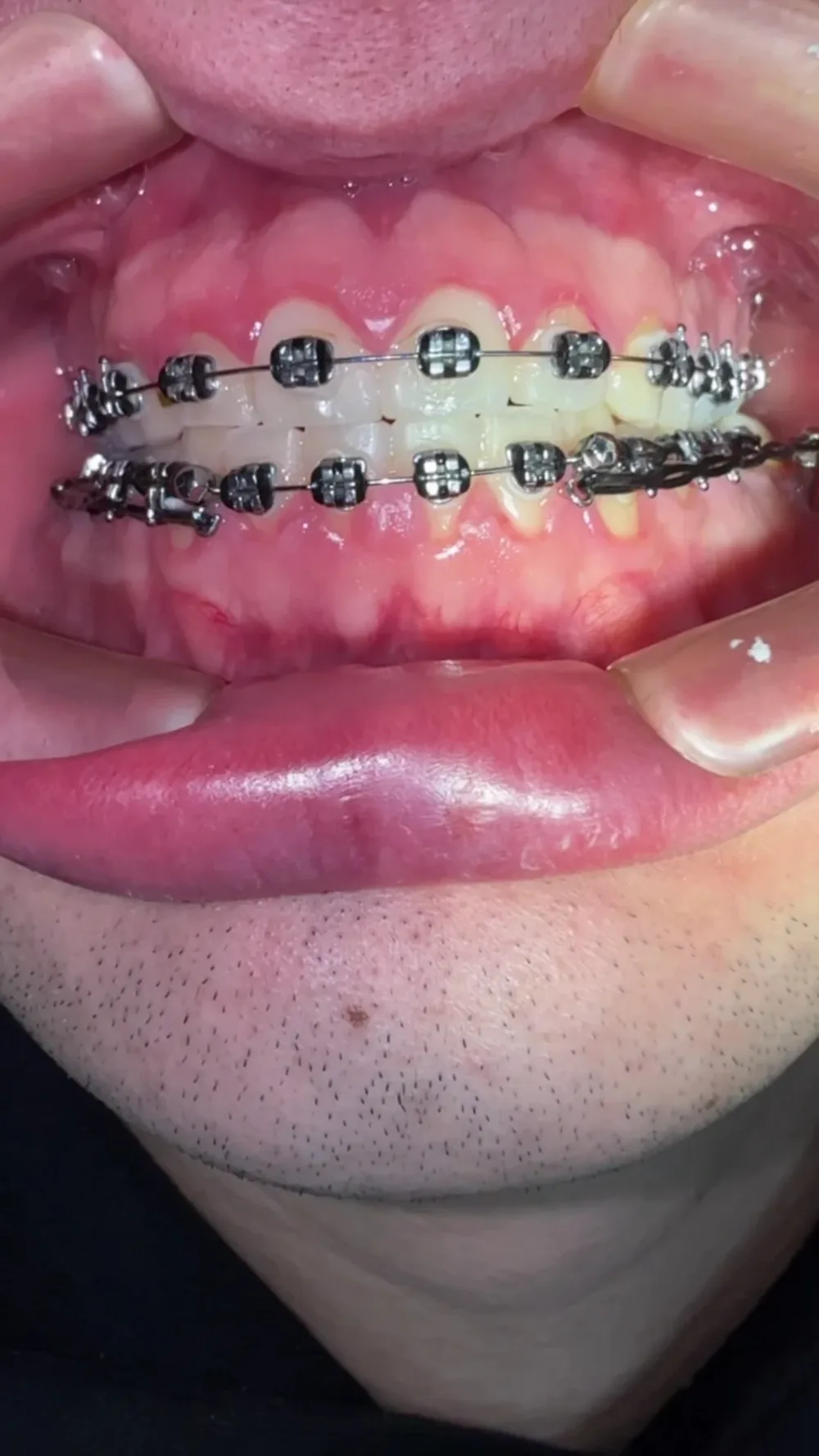VianPlus - 2